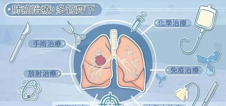 肺癌的治療選項(xiàng)有哪些？
